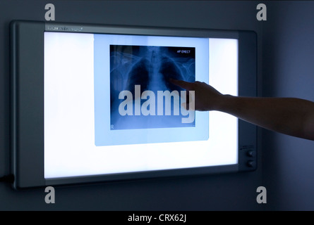 Une radiographie d'un chesst du patient en cours d'examen sur un écran de contrôle mural Banque D'Images