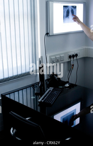 Une radiographie de la poitrine du patient en cours d'examen sur un écran de contrôle mural Banque D'Images