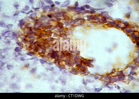 FTAL histologie pulmonaire Banque D'Images