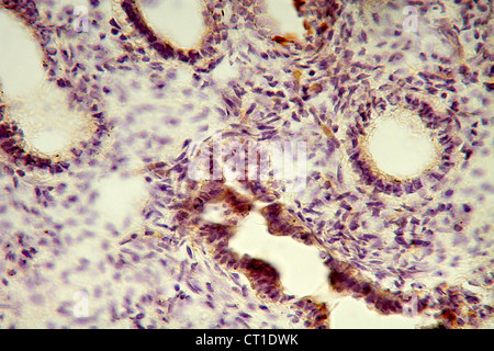 FTAL histologie pulmonaire Banque D'Images