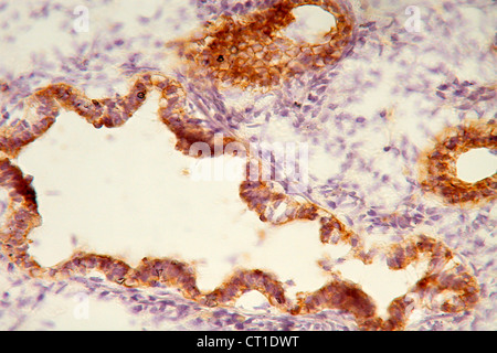 FTAL histologie pulmonaire Banque D'Images