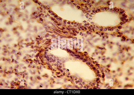 FTAL histologie pulmonaire Banque D'Images