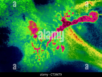 La parotidite, X-RAY Banque D'Images