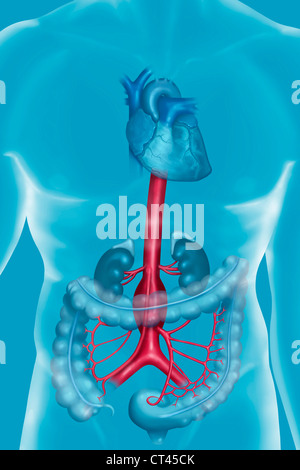 Anévrysme DE L'aorte abdominale Banque D'Images