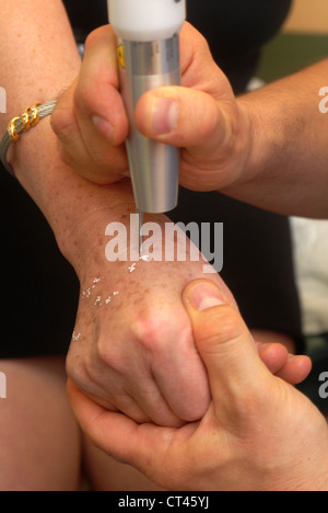 Dermatologie, TRAITER LES PERSONNES ÂGÉES P. Banque D'Images