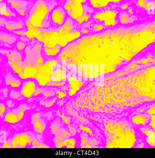 Alvéole pulmonaire, SEM Banque D'Images