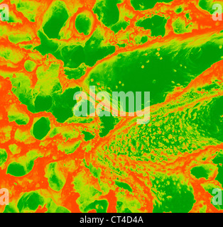 Alvéole pulmonaire, SEM Banque D'Images