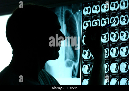 Londres, médecin évalue Roentgen et CT scan Banque D'Images