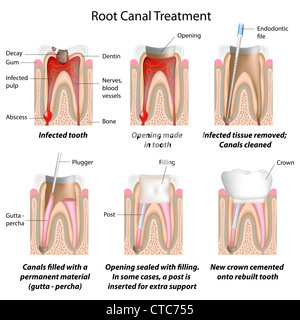 Le traitement de canal Banque D'Images