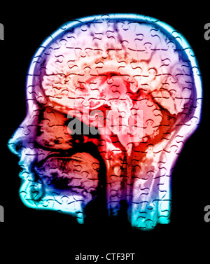 Image conceptuelle du cerveau humain Banque D'Images