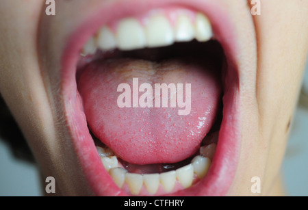 Enfants Adolescents bouche close up dents Lèvres crier bouches ouvertes Banque D'Images