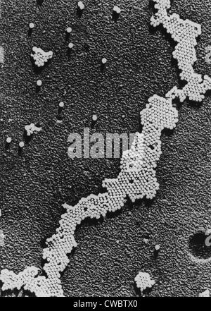 Le virus de la polio (poliomyélite), la cause de la paralysie infantile, a été découvert en 1908 par Karl Landsteiner. Le vaccin contre la Banque D'Images