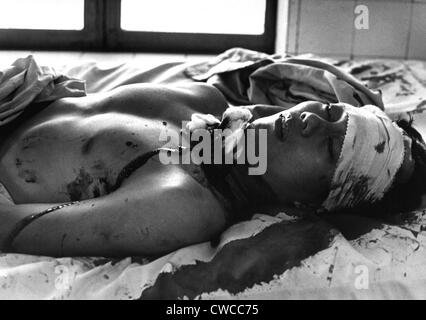Guerre du Vietnam. L'une des 48 personnes blessées par un Viet Cong explosion qui a tué 14 personnes à Saigon vous attend dans le traitement Cong Banque D'Images