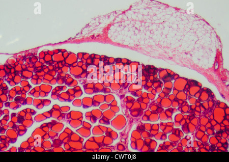 Medical science anthropotomy article microscopique physiologie de la glande thyroïde background Banque D'Images