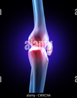 La douleur du genou avec un x-ray medical illustration d'une vue latérale close up macro d'un squelette humain avec la zone douloureuse en rouge montrant une blessure sportive ou d'un accident de travail physique dans la jambe. Banque D'Images