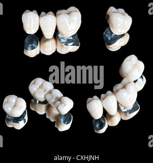 Dents en céramique Banque D'Images