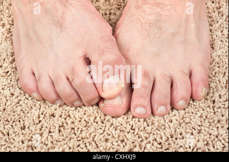 Un homme avec Itchy Feet utilise son gros orteil à zéro son autre pied. Bon pour les soins d'inférences. Banque D'Images