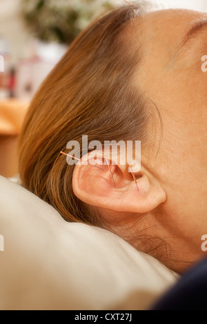 L'oreille, l'acupuncture, la médecine traditionnelle chinoise Banque D'Images