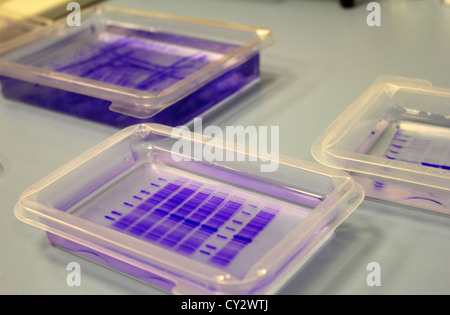 Gels de protéines colorés au bleu de Coomassie Banque D'Images