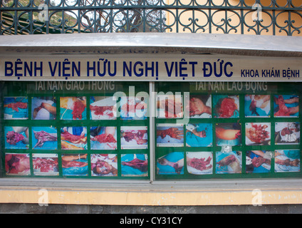 Photos d'une campagne de sensibilisation sur les dangers de l'avertissement de pétards, Hanoi, Vietnam Banque D'Images