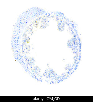 Hydra sous le microscope, l'arrière-plan Banque D'Images