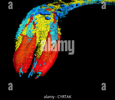 Caenorhabditis elegans, un nématode (ver rond transparent) Banque D'Images