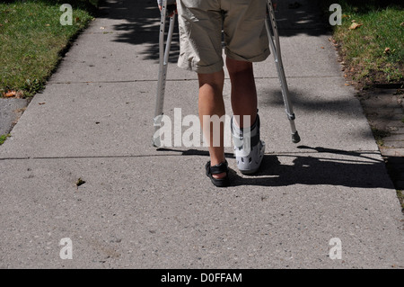 Femme marche avec deux béquilles sur un trottoir sur un jour d'été, ensoleillé, Ontario, Canada Banque D'Images