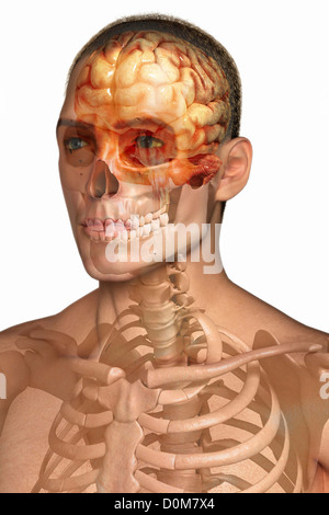 Vue de trois-quarts de l'os de la tête et du cou. Le cerveau est également visible dans la tête. Banque D'Images