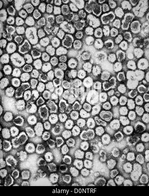 Teinté négativement cette micrographie électronique à transmission (MET) a révélé la présence de crosse (BAC) virus de l'encéphalite japonaise Banque D'Images