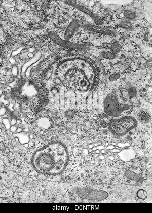 Cette micrographie électronique à transmission (MET) a révélé nombre de présence de l'Encéphalite équine de l'Est (EEE) du virus que les virions Banque D'Images