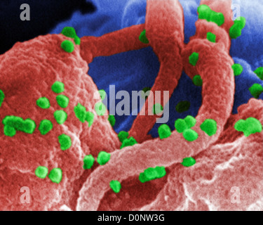 Cette micrographie électronique à balayage a révélé la présence du virus de l'immunodéficience humaine (VIH-1) (sphérique en apparence) qui avait Banque D'Images