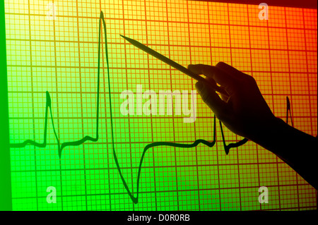 Vue conceptuelle d'une main avec un pointeur projetée sur un moniteur d'électrocardiogramme électrocardiogramme Banque D'Images