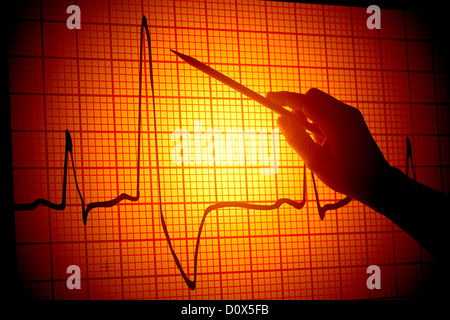 Vue conceptuelle d'une main avec un pointeur projetée sur un moniteur d'électrocardiogramme électrocardiogramme Banque D'Images