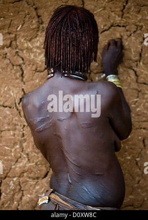 Vue arrière des cicatrices sur le dos d'une femme de la tribu Hamar Après Flagellation Cérémonie, Turmi, vallée de l'Omo, Ethiopie Banque D'Images