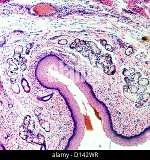 Microphotographie de la science médicale épithélium pavimenteux stratifié cellules tissulaires Banque D'Images