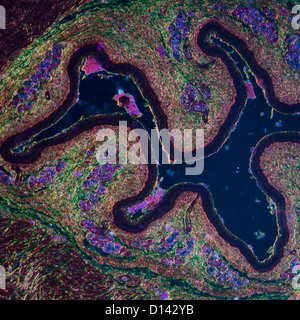 Microphotographie de la science médicale épithélium pavimenteux stratifié cellules tissulaires Banque D'Images