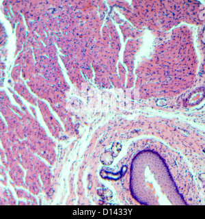 Microphotographie de la science médicale épithélium pavimenteux stratifié cellules tissulaires Banque D'Images