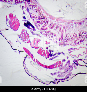 Micrographie de la science des insectes corps coupe transversale, espèce de Caterpillar prodenia litura, avec celui de la teinture. Banque D'Images