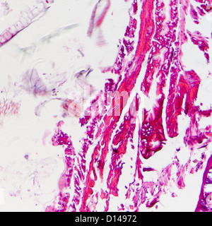 Micrographie de la science des insectes corps coupe transversale, espèce de Caterpillar prodenia litura, avec celui de la teinture. Banque D'Images