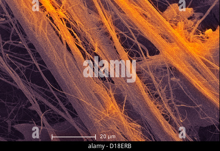 Micrographie électronique à balayage de l'amiante, 1200x