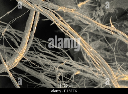 Micrographie électronique à balayage de l'amiante, 1500 x Banque D'Images