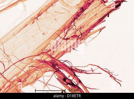 Micrographie électronique à balayage de l'amiante Banque D'Images