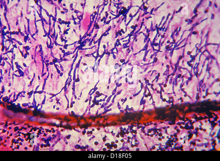 Micrograph Light de champignon Candida Banque D'Images