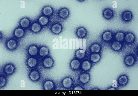 Des électrons Microphotographie d'adénovirus équin Banque D'Images