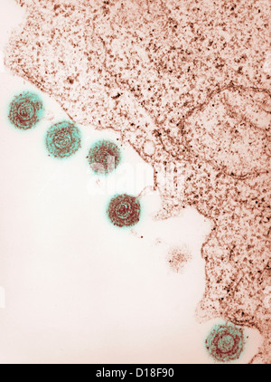 Micrographe de virus herpétique humain-6, le HHV-6 Banque D'Images