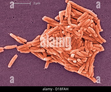 Micrographe de bactéries Legionella, 6500x Banque D'Images