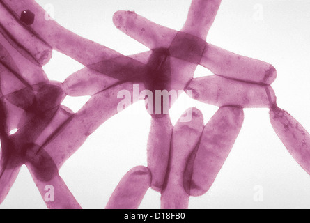 Micrographe de bactéries Legionella, 6500x Banque D'Images