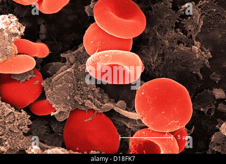 Micrographe des globules rouges et de la fibrine Banque D'Images