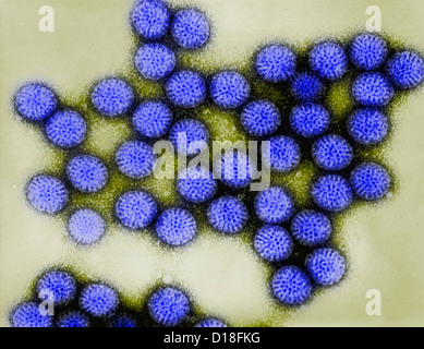 Micrographie électronique à transmission de l'infection à rotavirus Banque D'Images