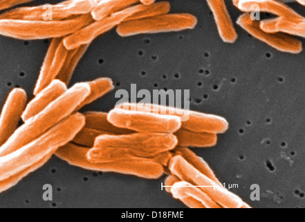 Micrographe de Mycobacterium tuberculosis Banque D'Images